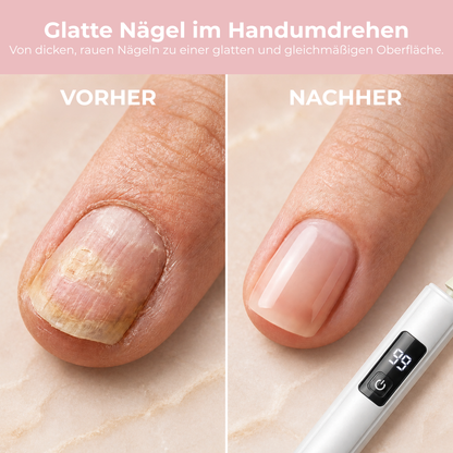 NailPro™ - Professionelle Nägel — bequem von zuhause!