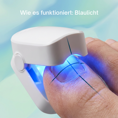 ClearNegl™ - Verabschiede dich für immer von verfärbten und ungesunden Nägeln!