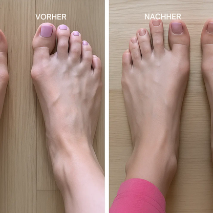 ZehFix™ - Korrigiere deine Zehen sanft und bequem!