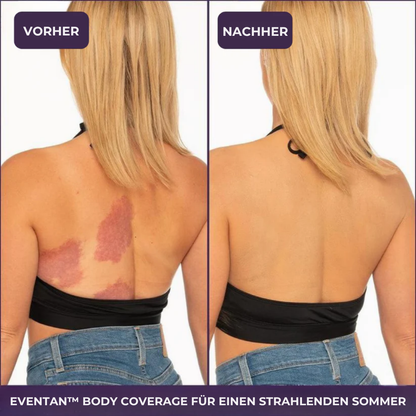 EvenTan™ - Die perfekte Creme für den ganzen Körper!