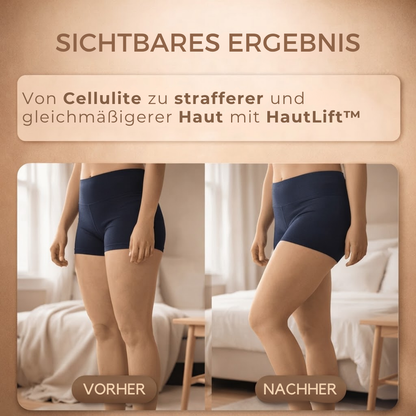 HautLift™ - Straffe und forme deine Haut mit Vakuummassage!